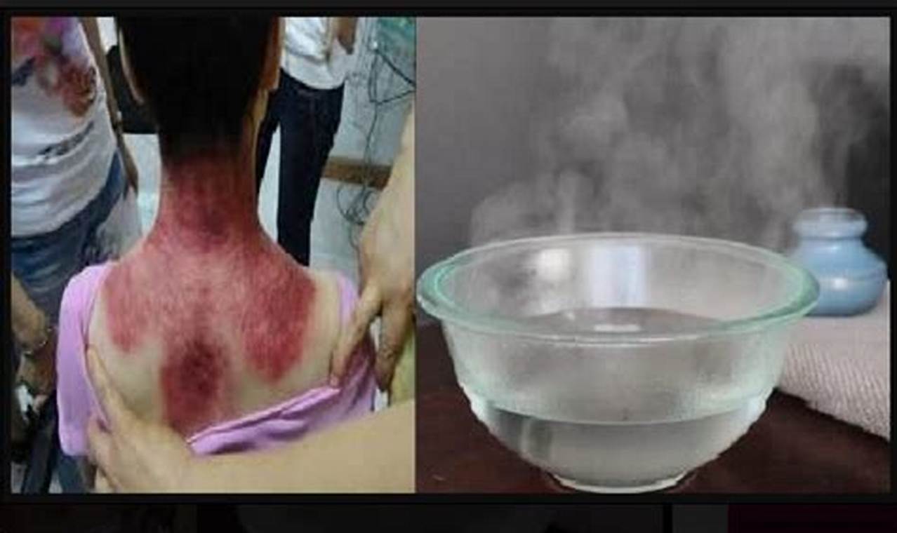 Cara Mengatasi Angin Duduk: Panduan Lengkap